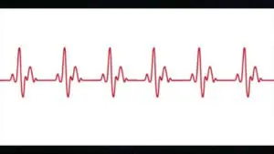 Heartbeat sound